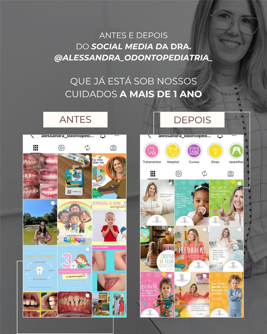 Antes e depois do Instagram da Dra. Alessandra, odontopediatra